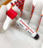 בדיקה סרולוגית - תמונת המחשה